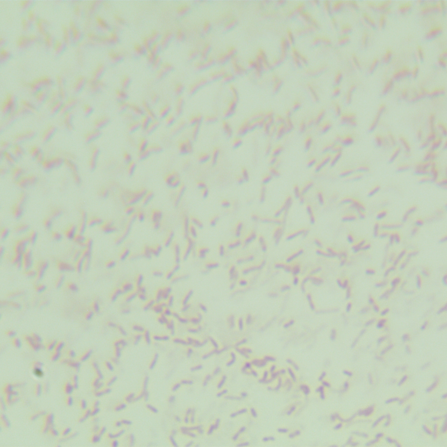 Pseudomonas aeruginosa-BNCC