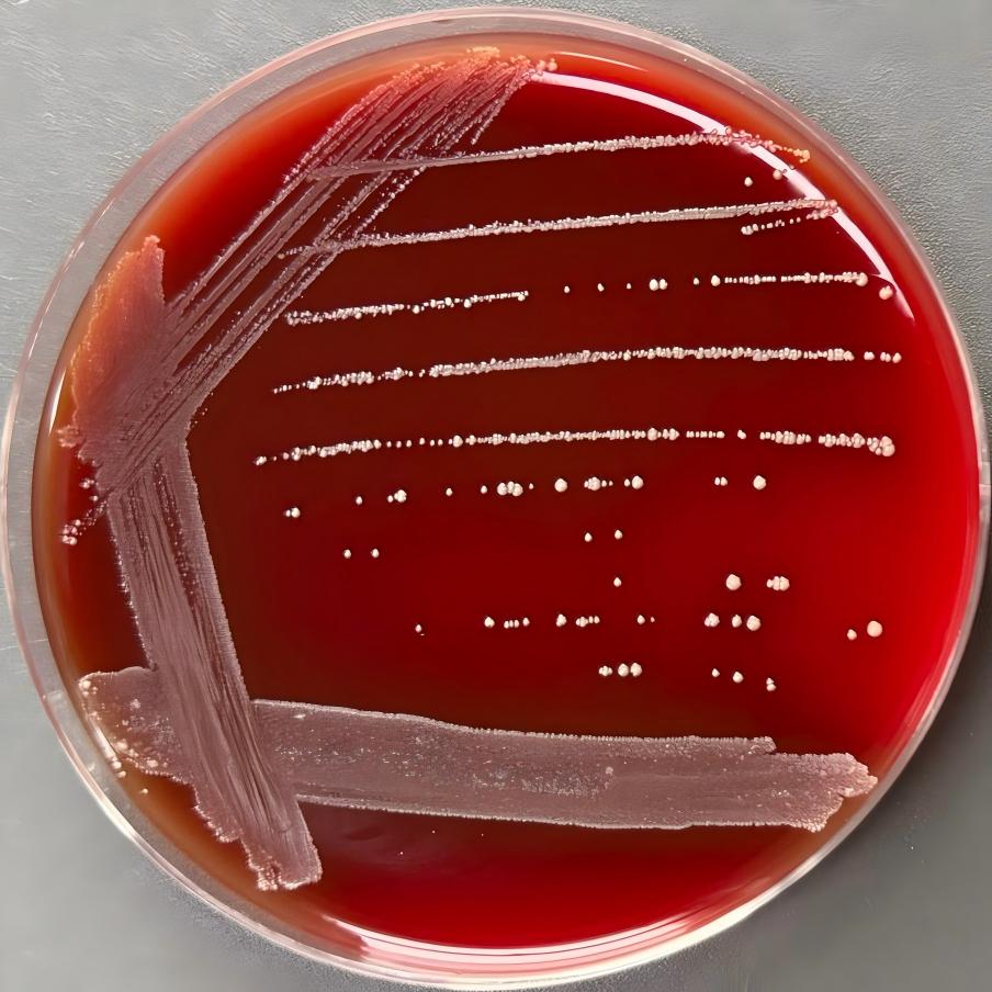 Prevotella anaerobes-BNCC