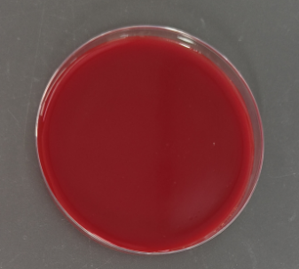 Indoor quality control product for deoxyribonucleic acid liquid of Corynebacterium urealyticum-BNCC