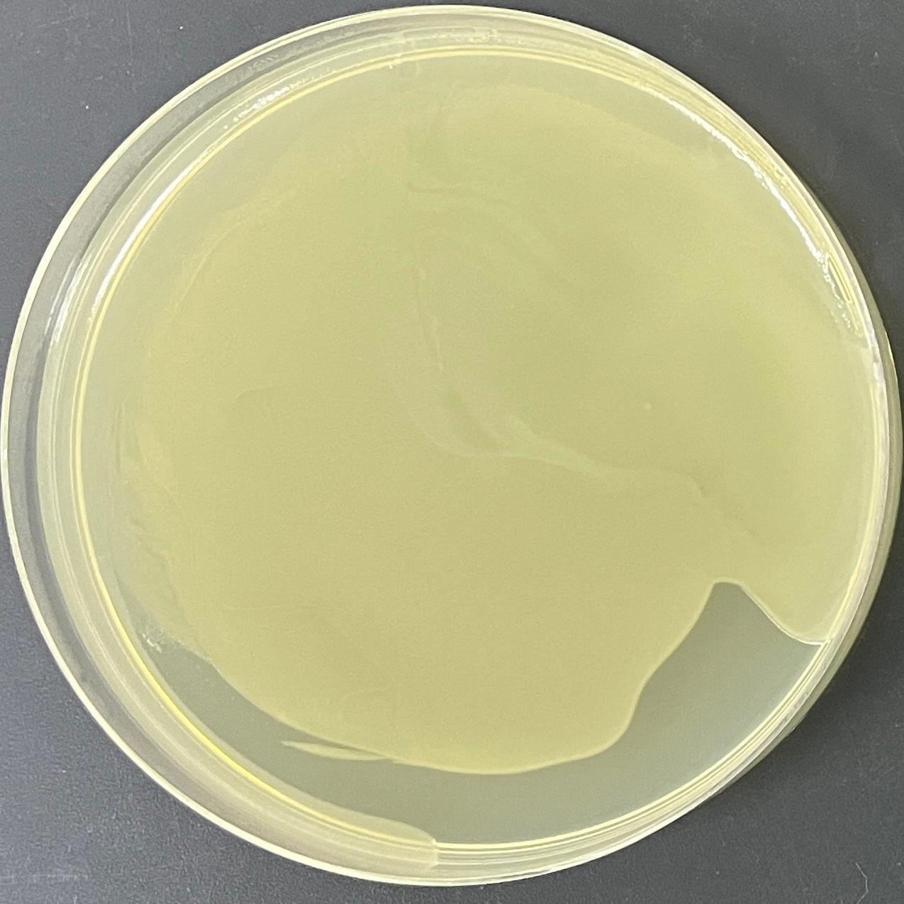 PUC57 (containing IS6110 plasmid) Escherichia coli-BNCC