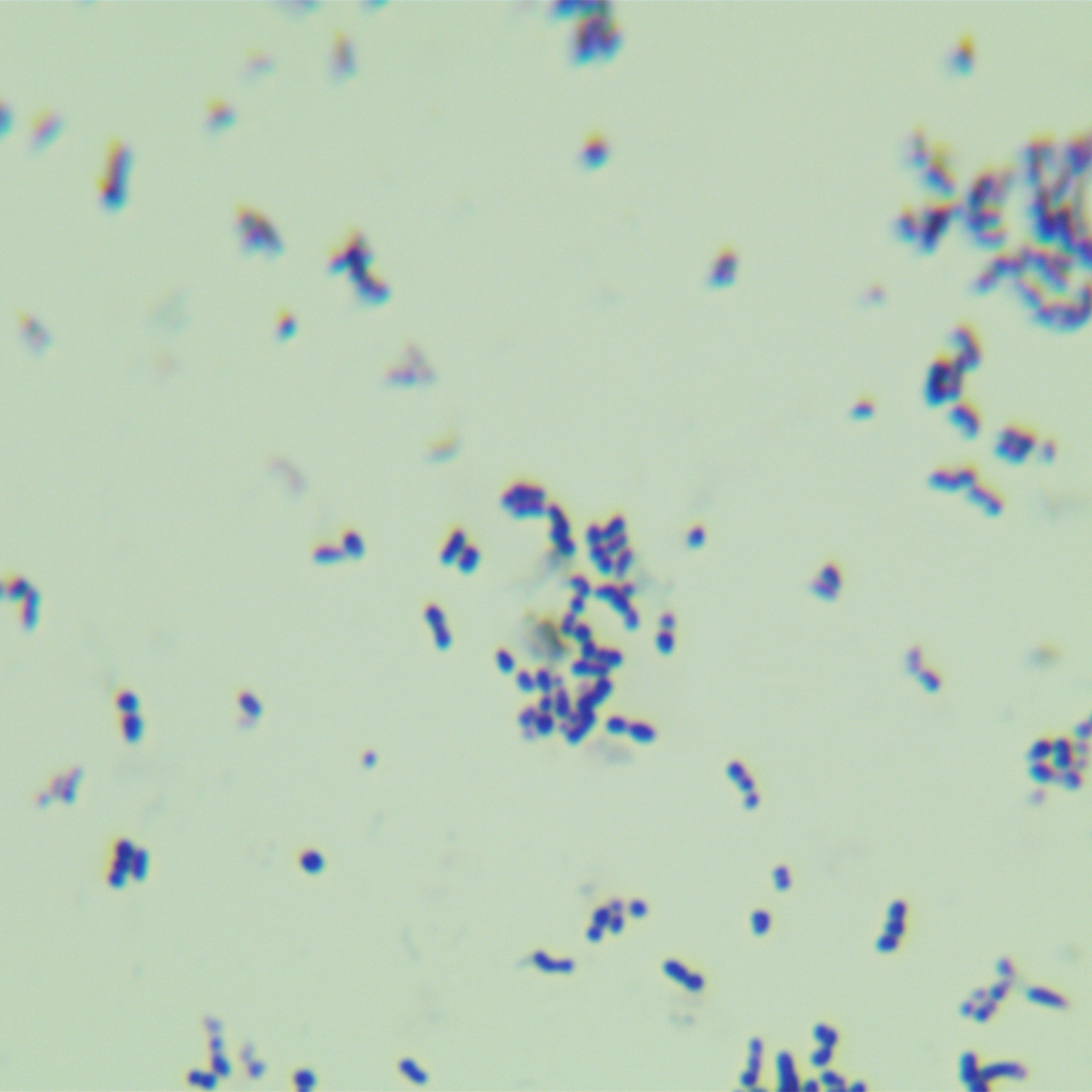Lactobacillus mastitis-BNCC