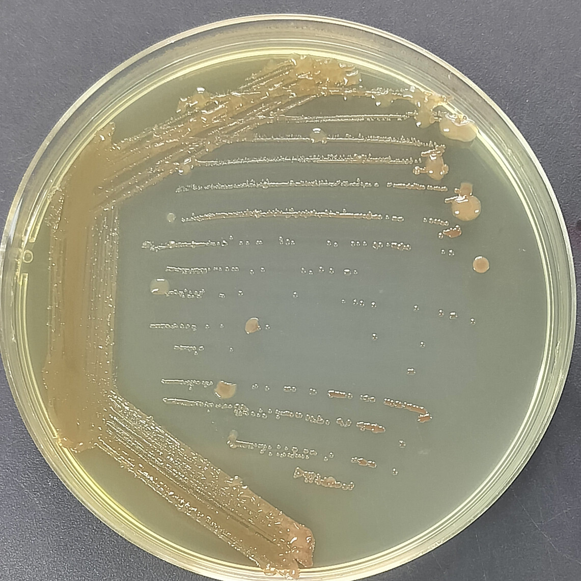 Pseudomonas aeruginosa-BNCC