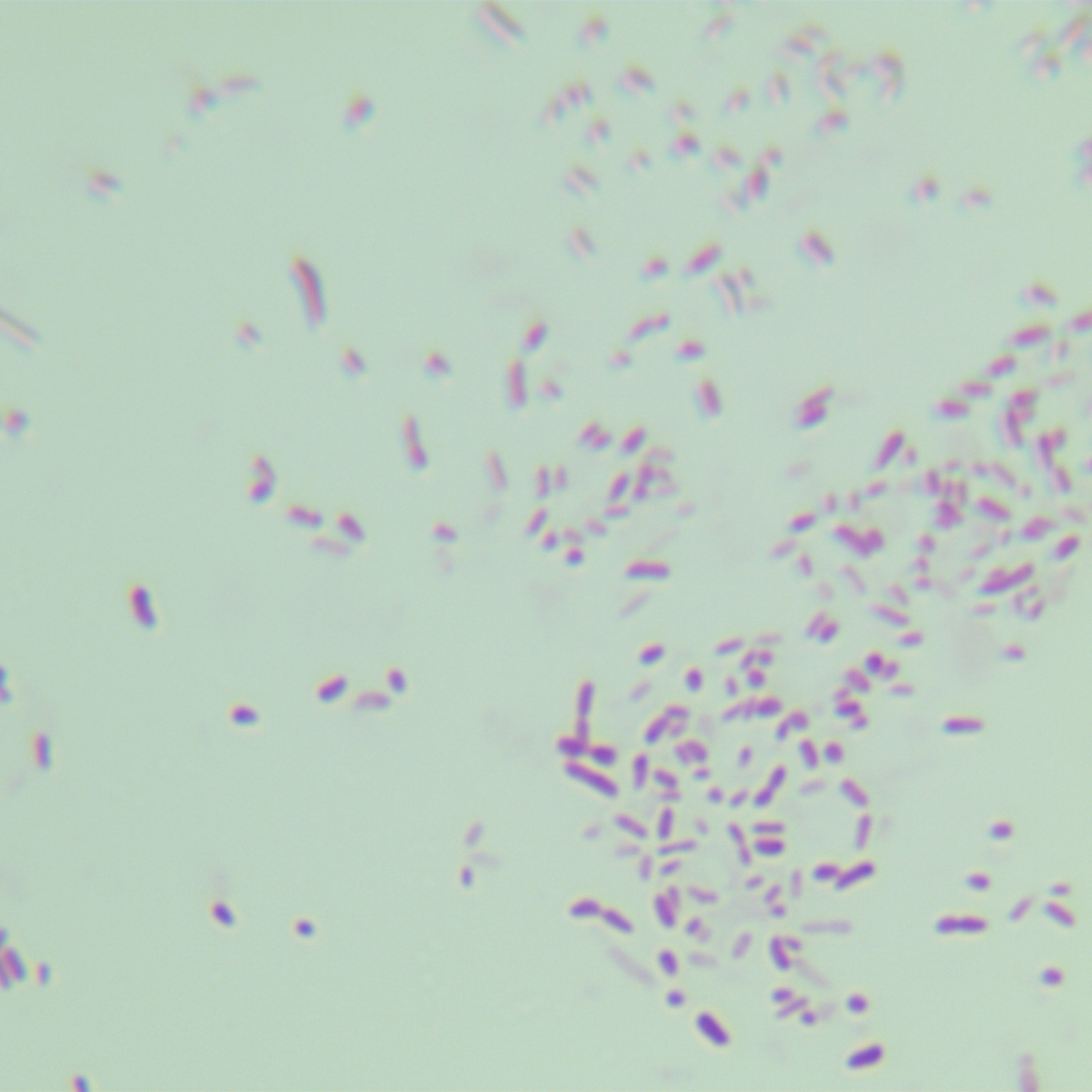 Pseudomonas aeruginosa-BNCC