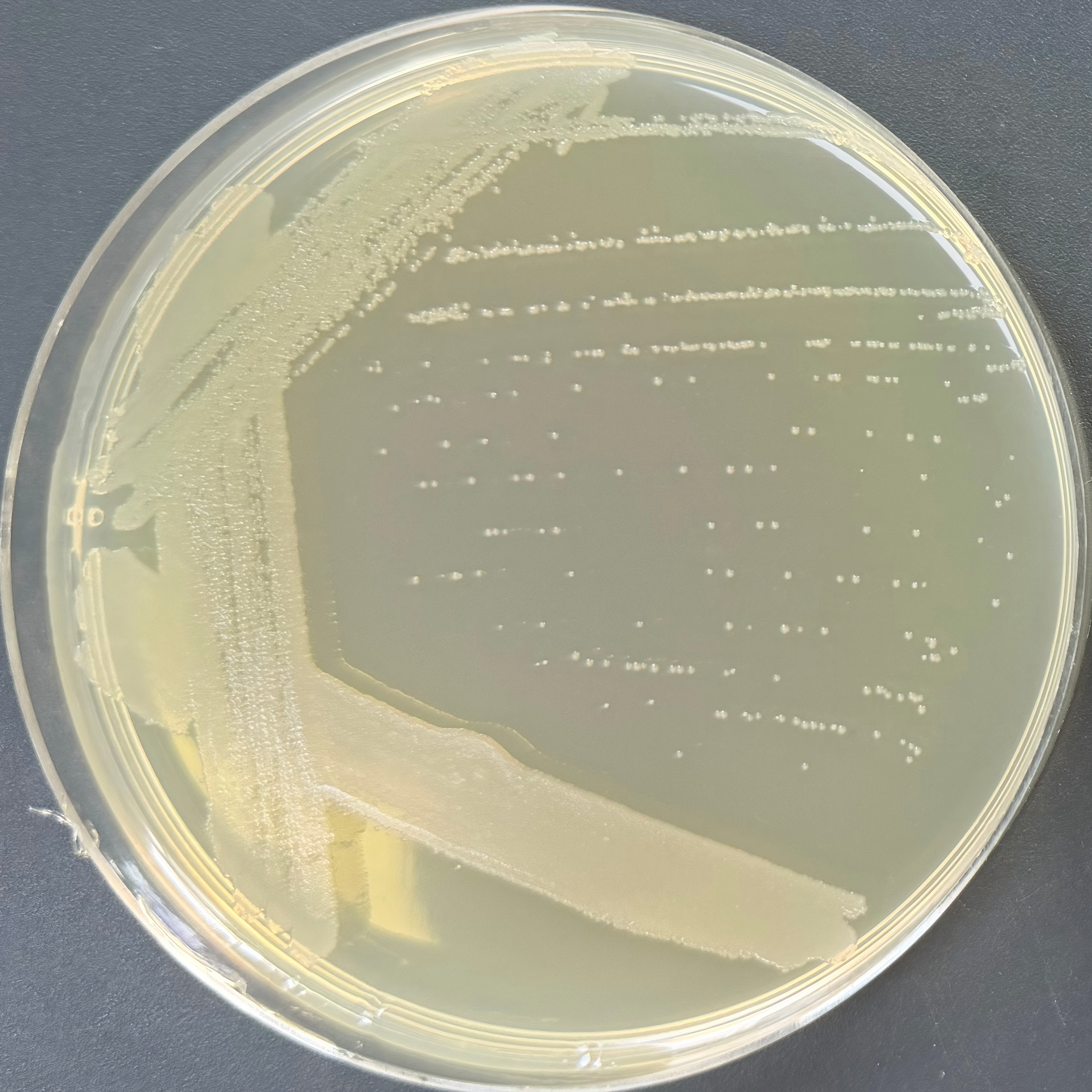Pseudomonas aeruginosa-BNCC