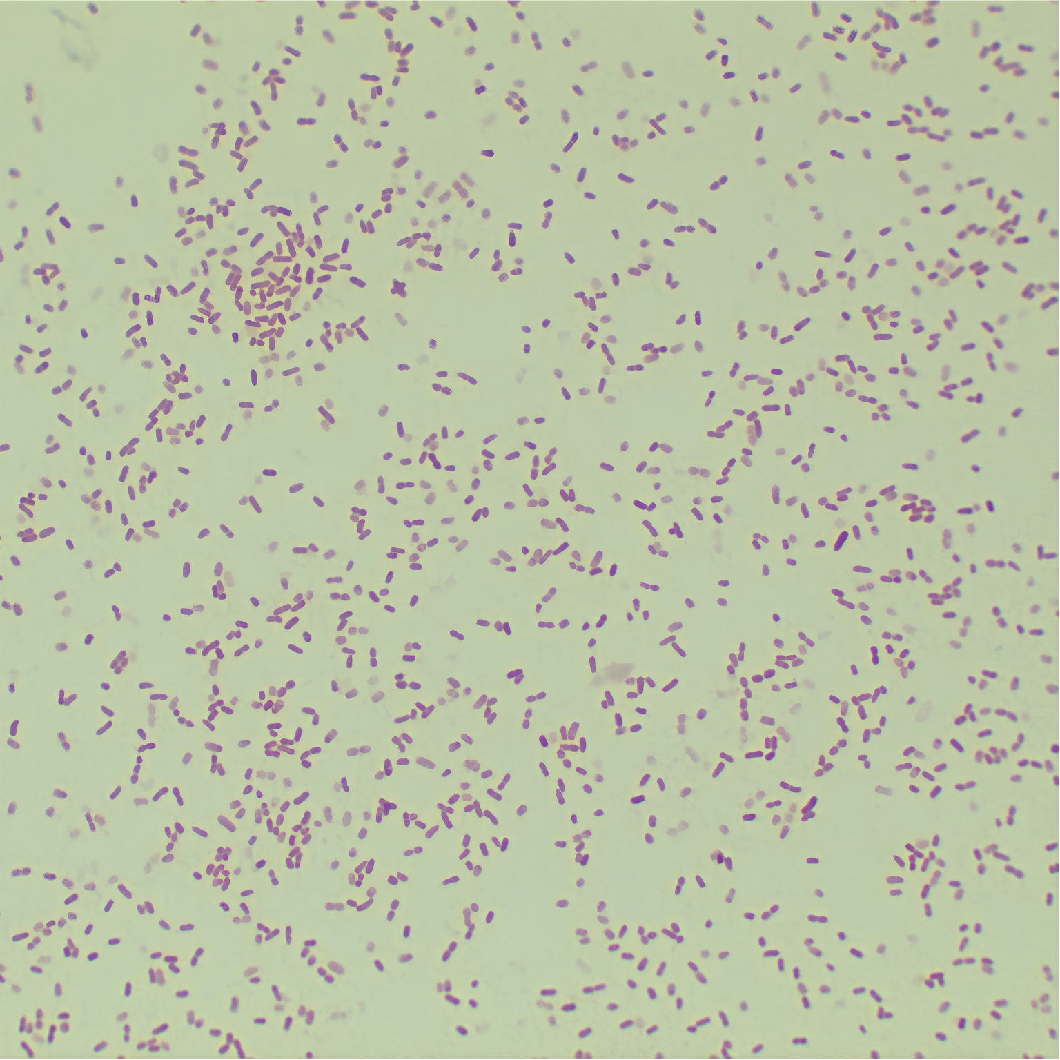 Pseudomonas aeruginosa-BNCC