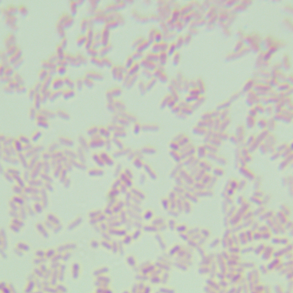 Escherichia coli HS (pCamp) R-BNCC