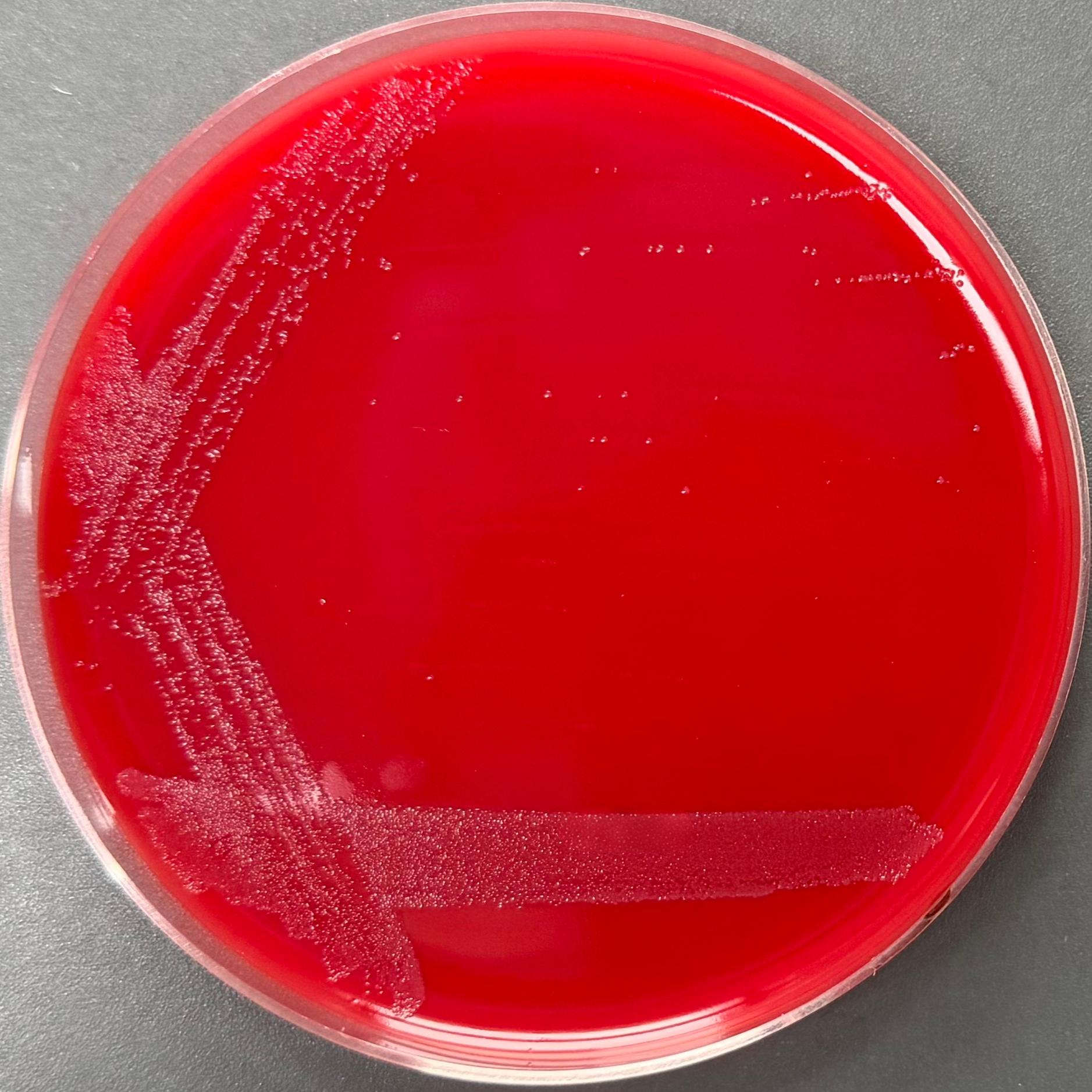 Clostridium perfringens-BNCC