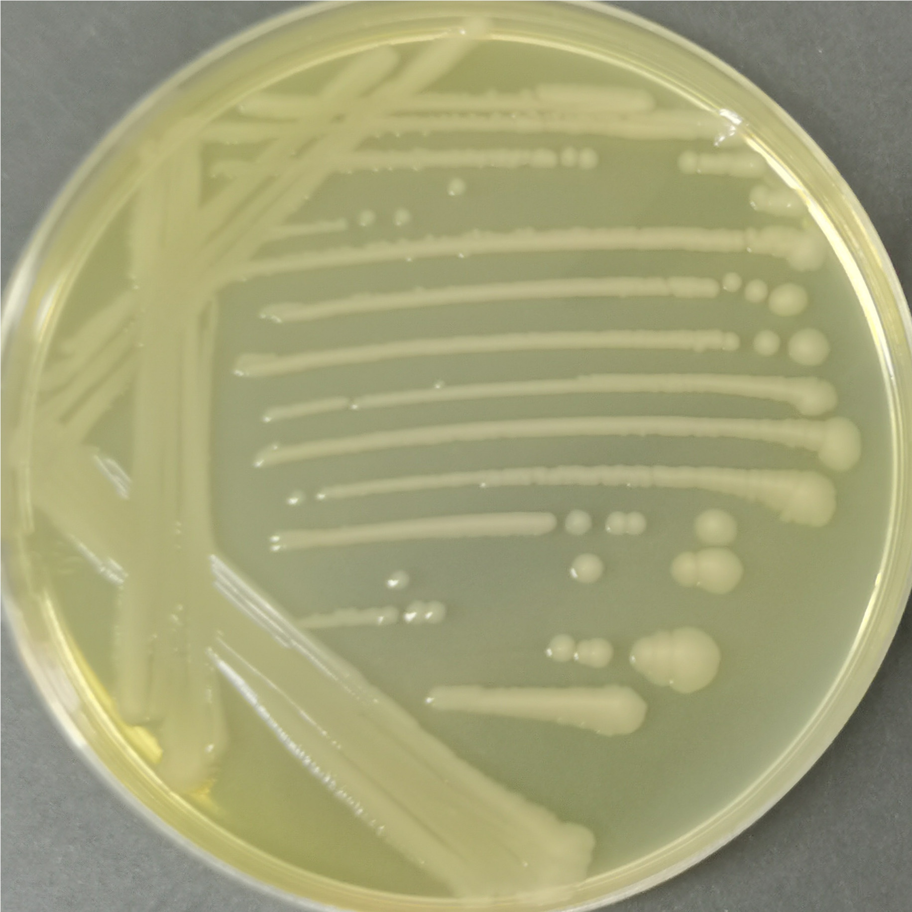 Salmonella enterica subsp. I 4,5,12: i: 1,2-BNCC