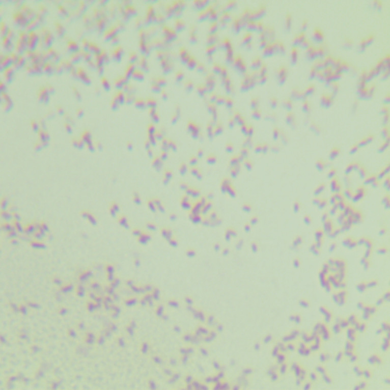 Salmonella enterica subsp. I 4,5,12: i: 1,2-BNCC