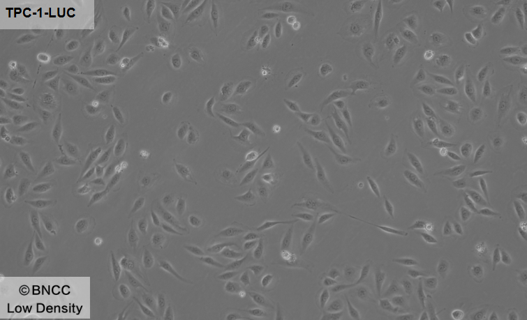 Human papillary thyroid carcinoma cells (labeled with luciferase)-BNCC