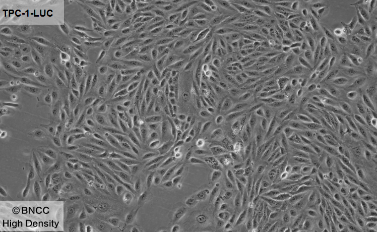 Human papillary thyroid carcinoma cells (labeled with luciferase)-BNCC