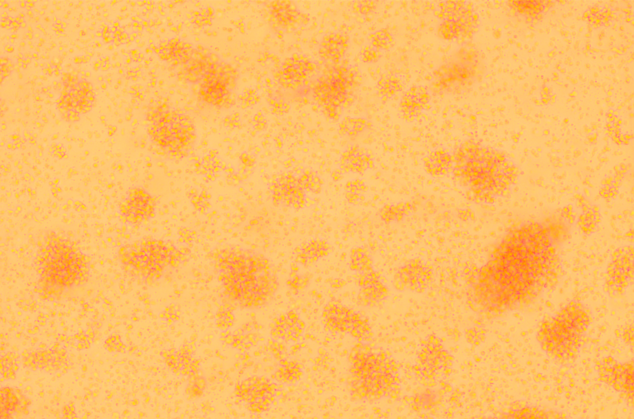 T cells that perform innate immune functions (gamma delta T)-BNCC