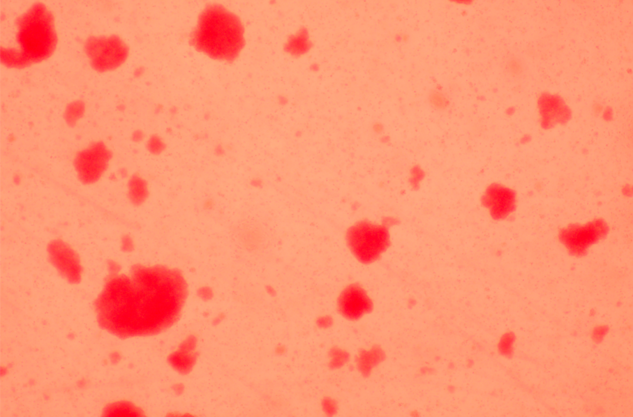 T cells that perform innate immune functions (gamma delta T)-BNCC