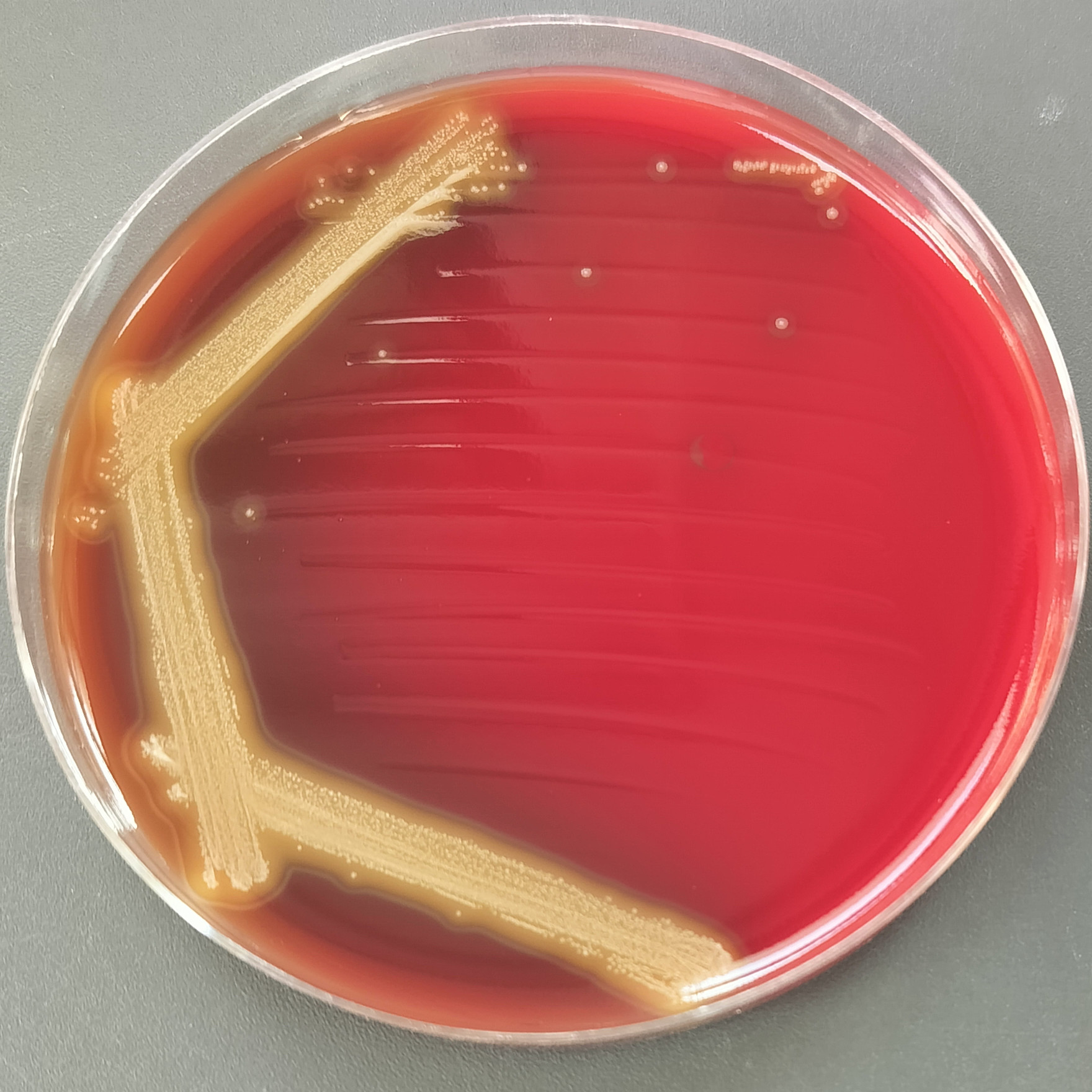 Streptococcus infantum-BNCC