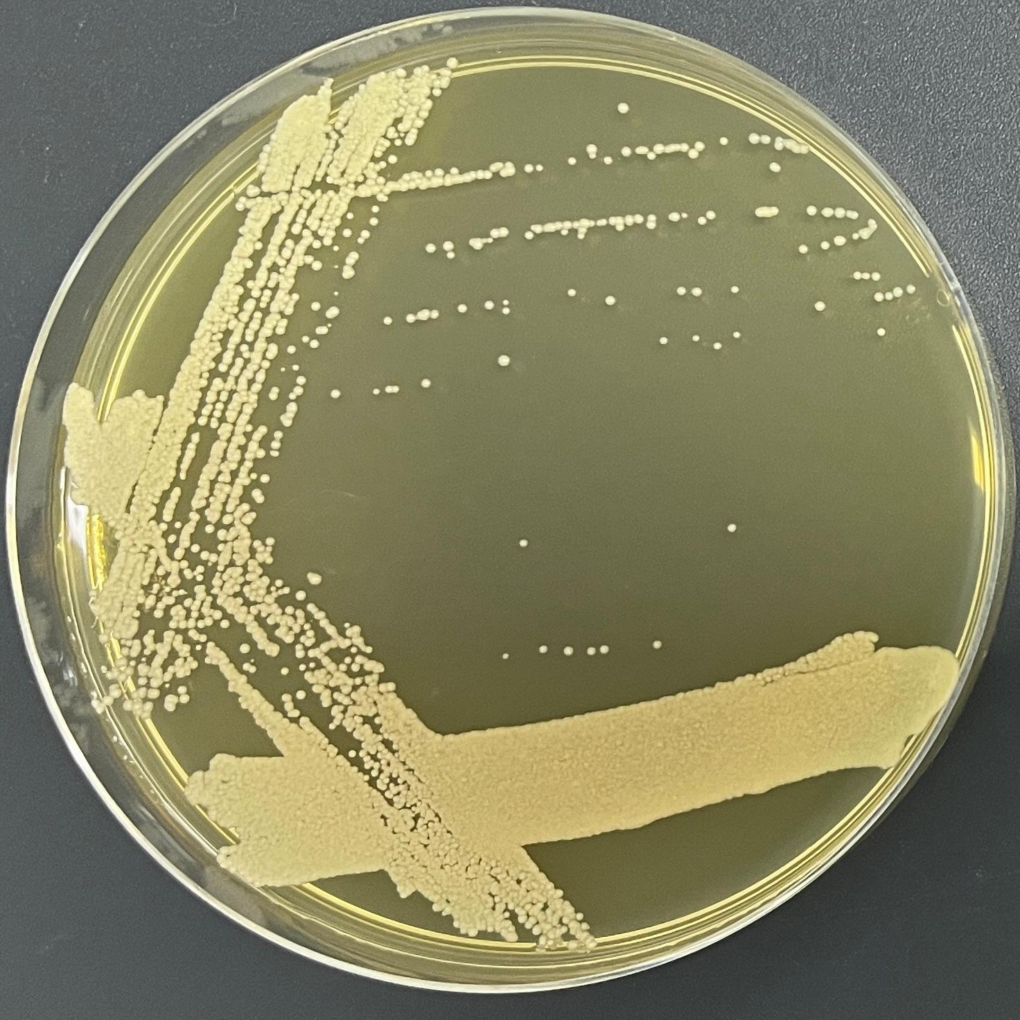 Nakase's Dextros yeast-BNCC