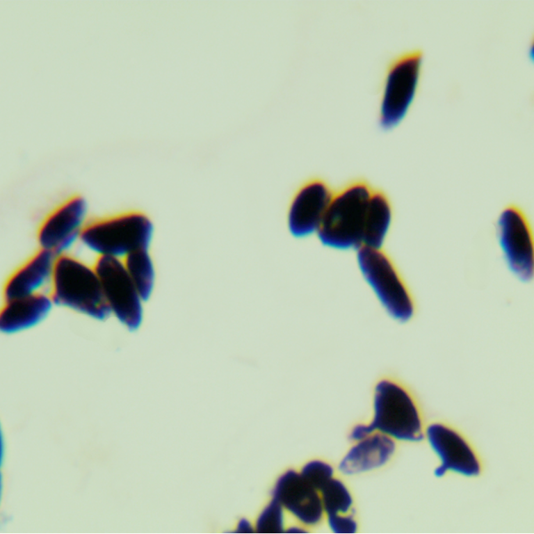 Nakase's Dextros yeast-BNCC