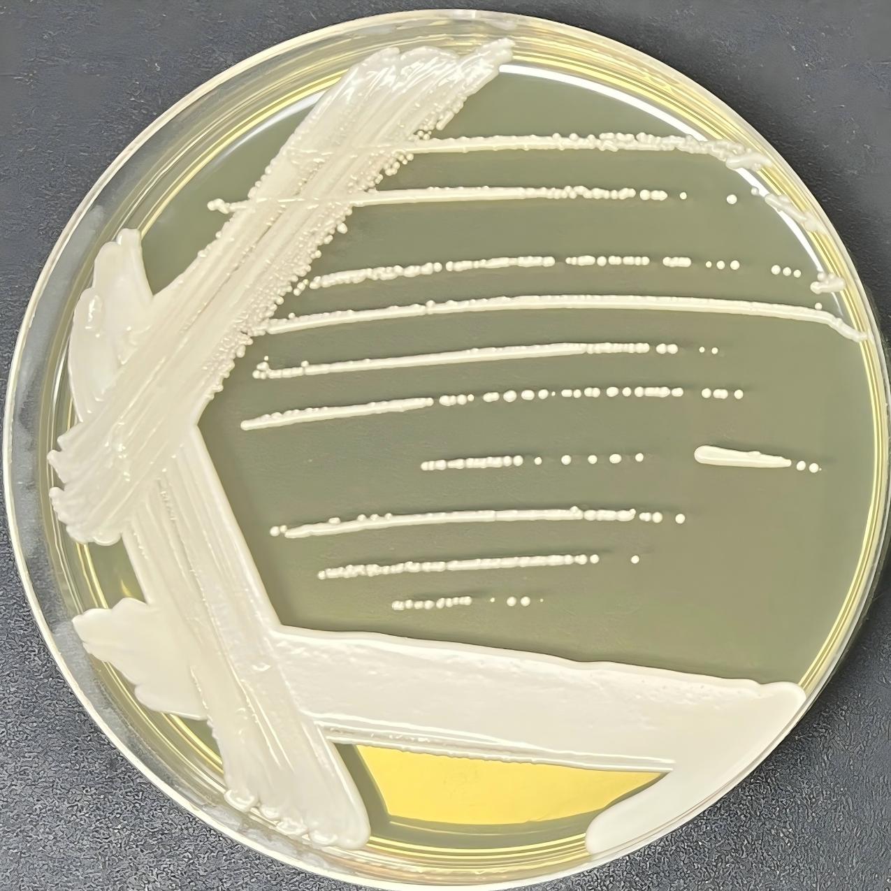 Cylindner yeast-BNCC