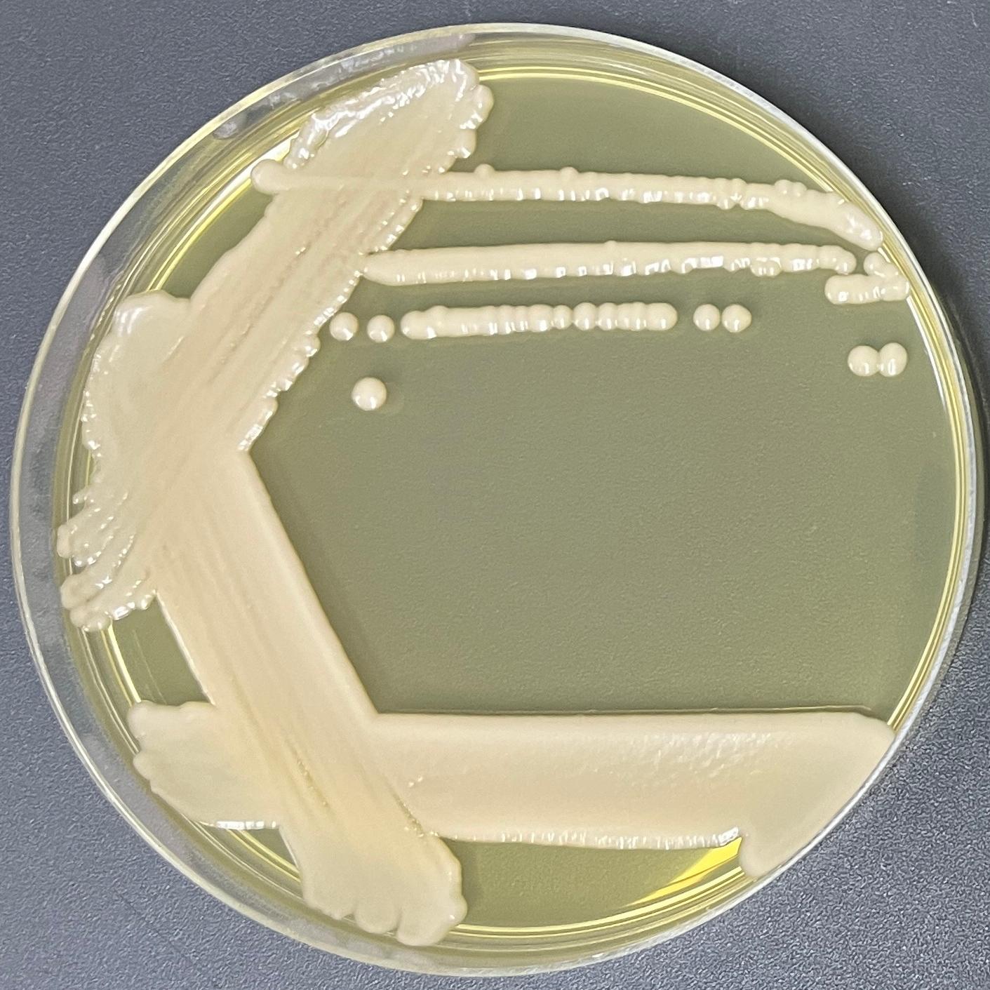 Some species of yeast belonging to the genus Nagata-BNCC