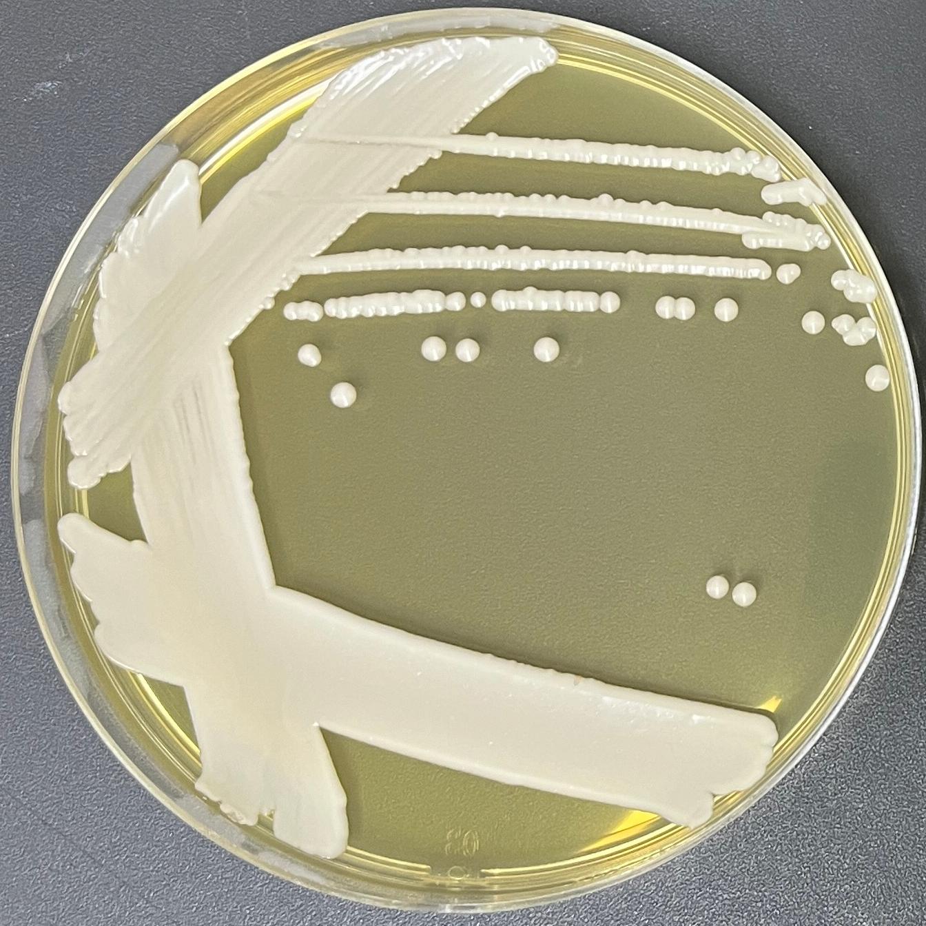 Saiberlindner's yeast genus-BNCC