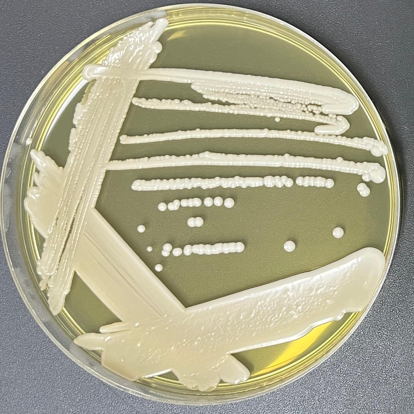 Depali yeast genus-BNCC