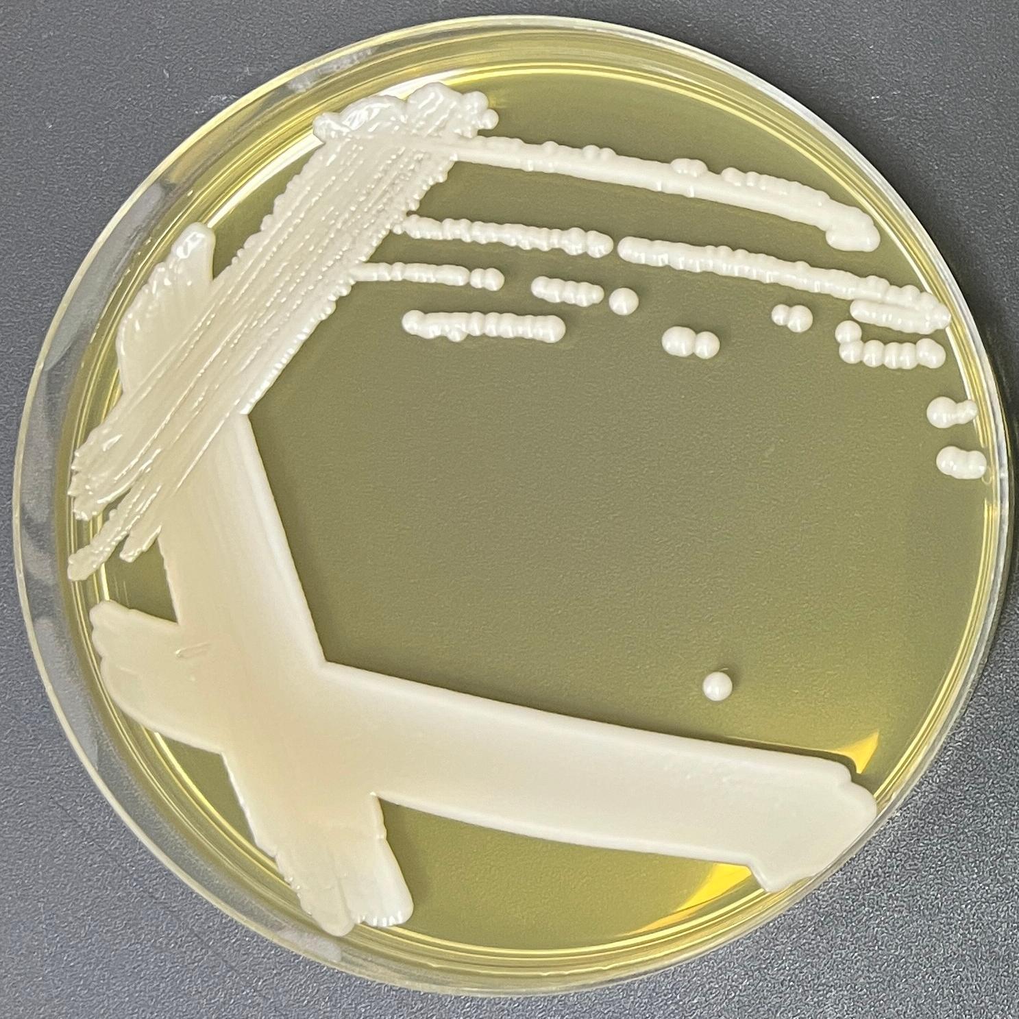 Depali yeast genus-BNCC