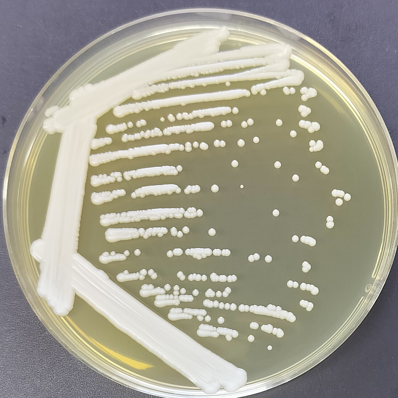 Isabella's yeast from Goto-BNCC
