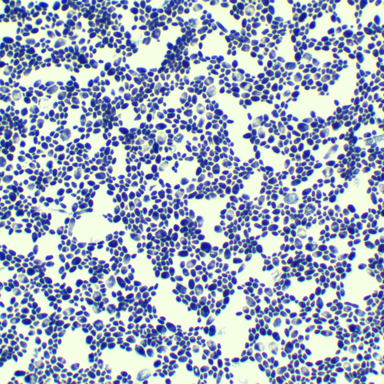 Forest dwelling post fungal Pichia pastoris-BNCC