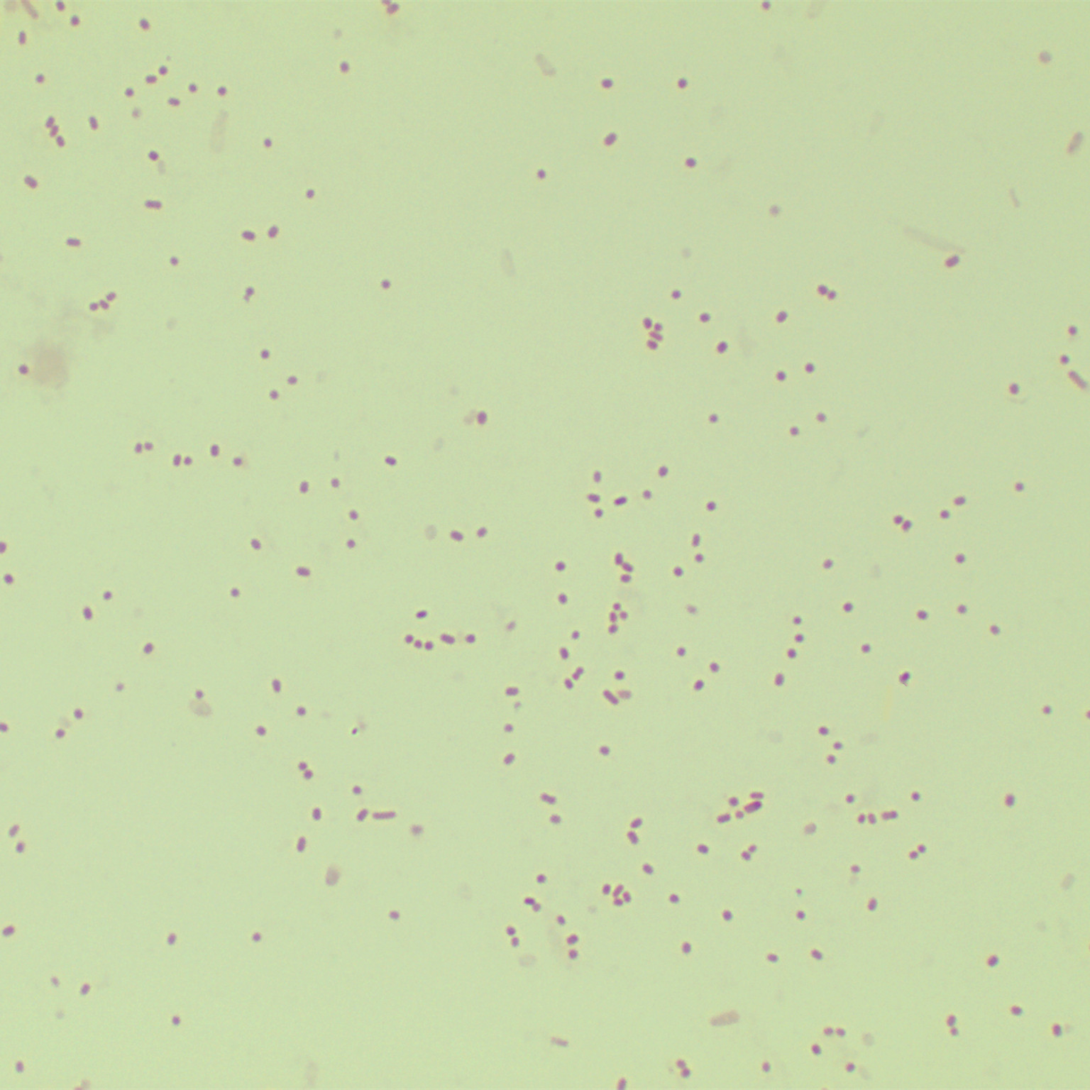 Escherichia coli-BNCC