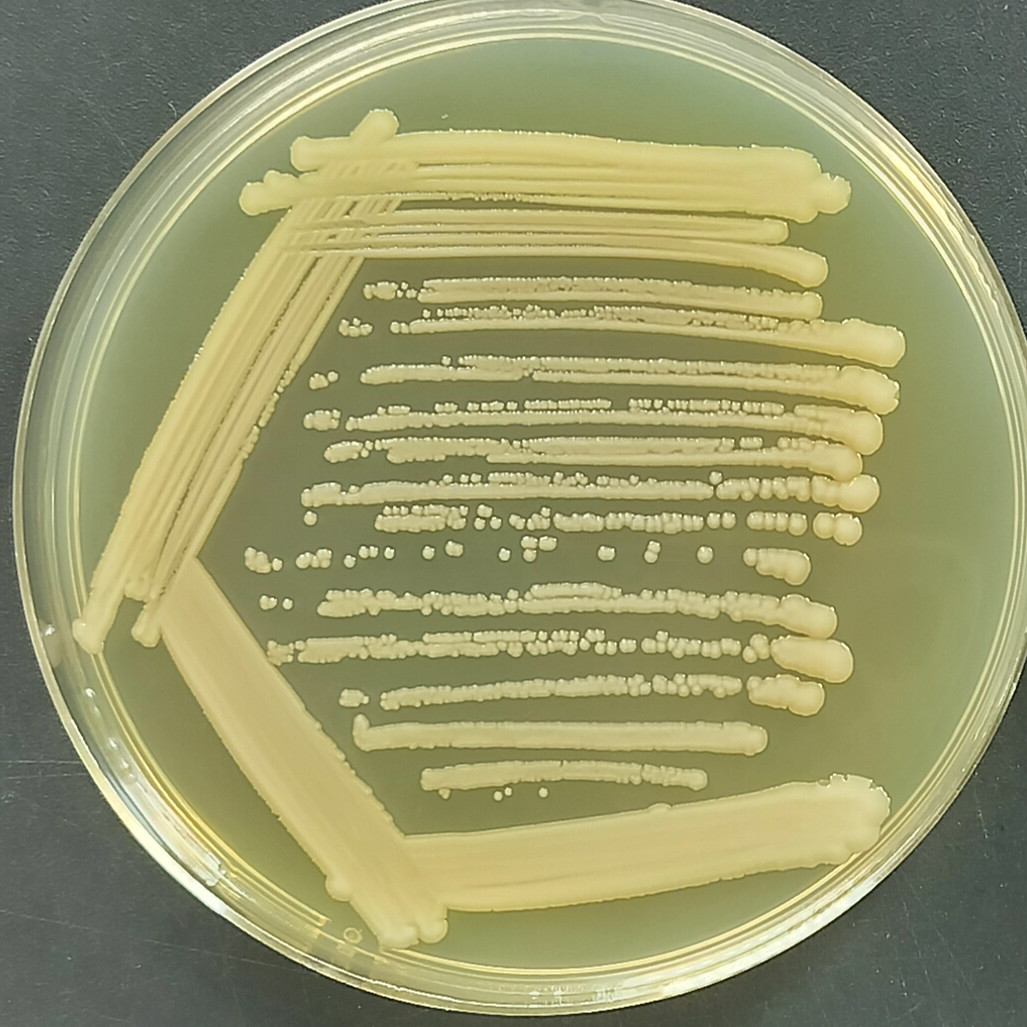 Indoor quality control material for Acinetobacter baumannii deoxyribonucleic acid liquid-BNCC