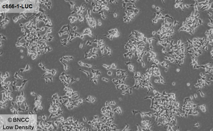 Human nasopharyngeal carcinoma cells (labeled with luciferase)-BNCC