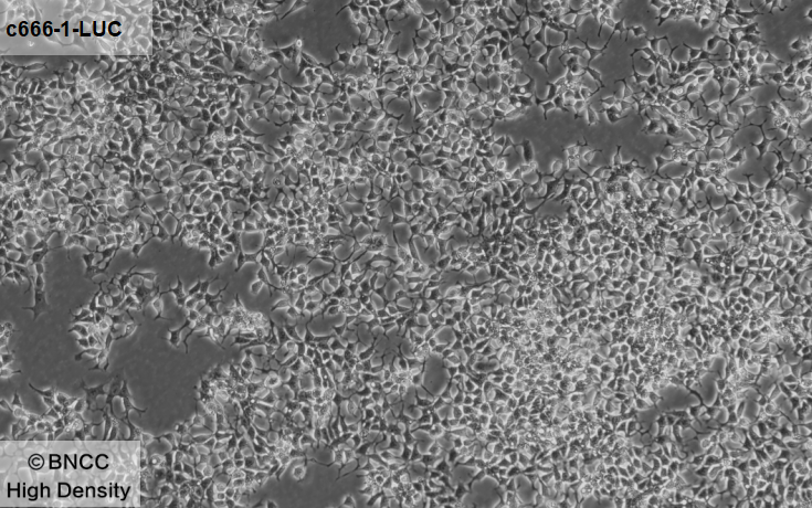 Human nasopharyngeal carcinoma cells (labeled with luciferase)-BNCC