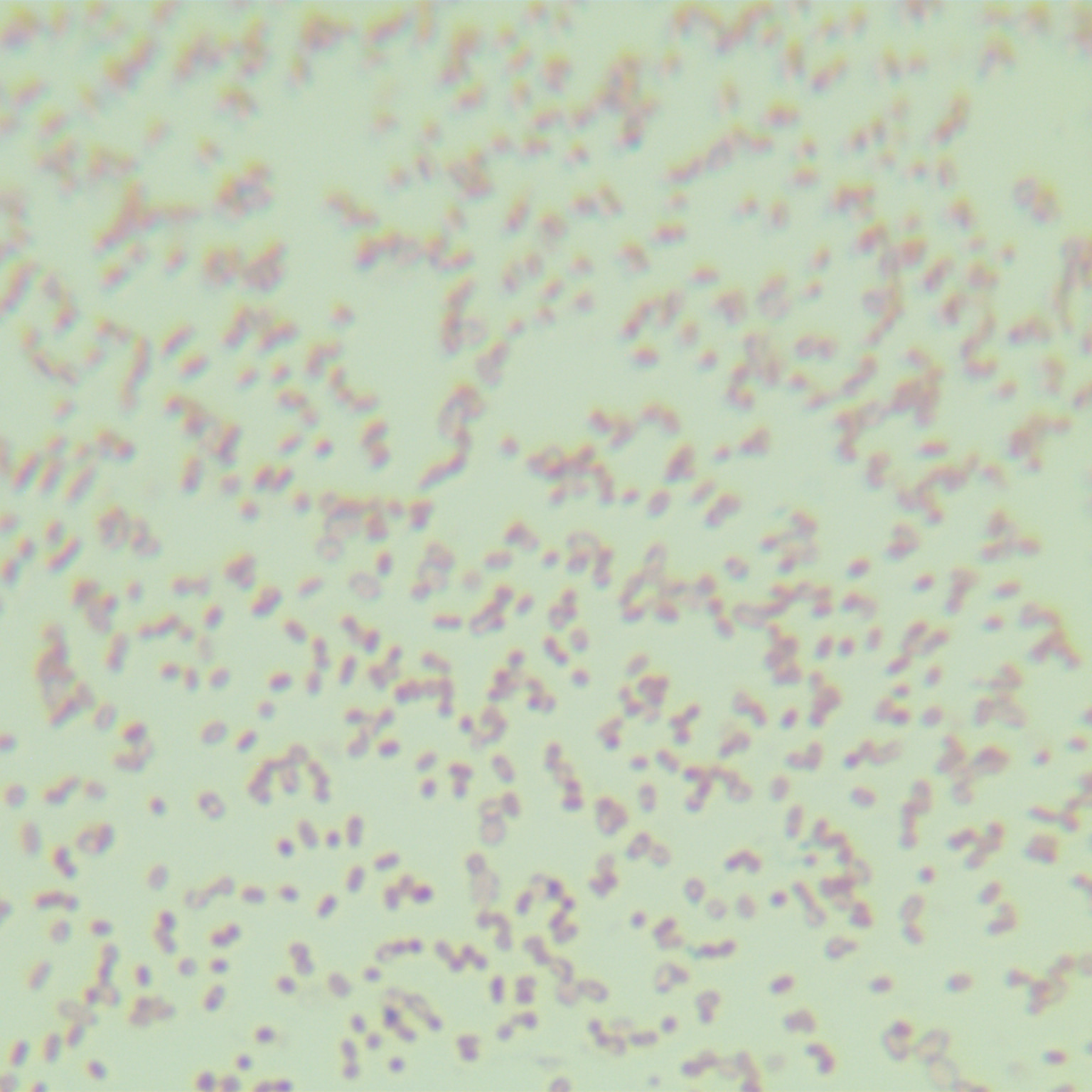 Bacillus cereus-BNCC