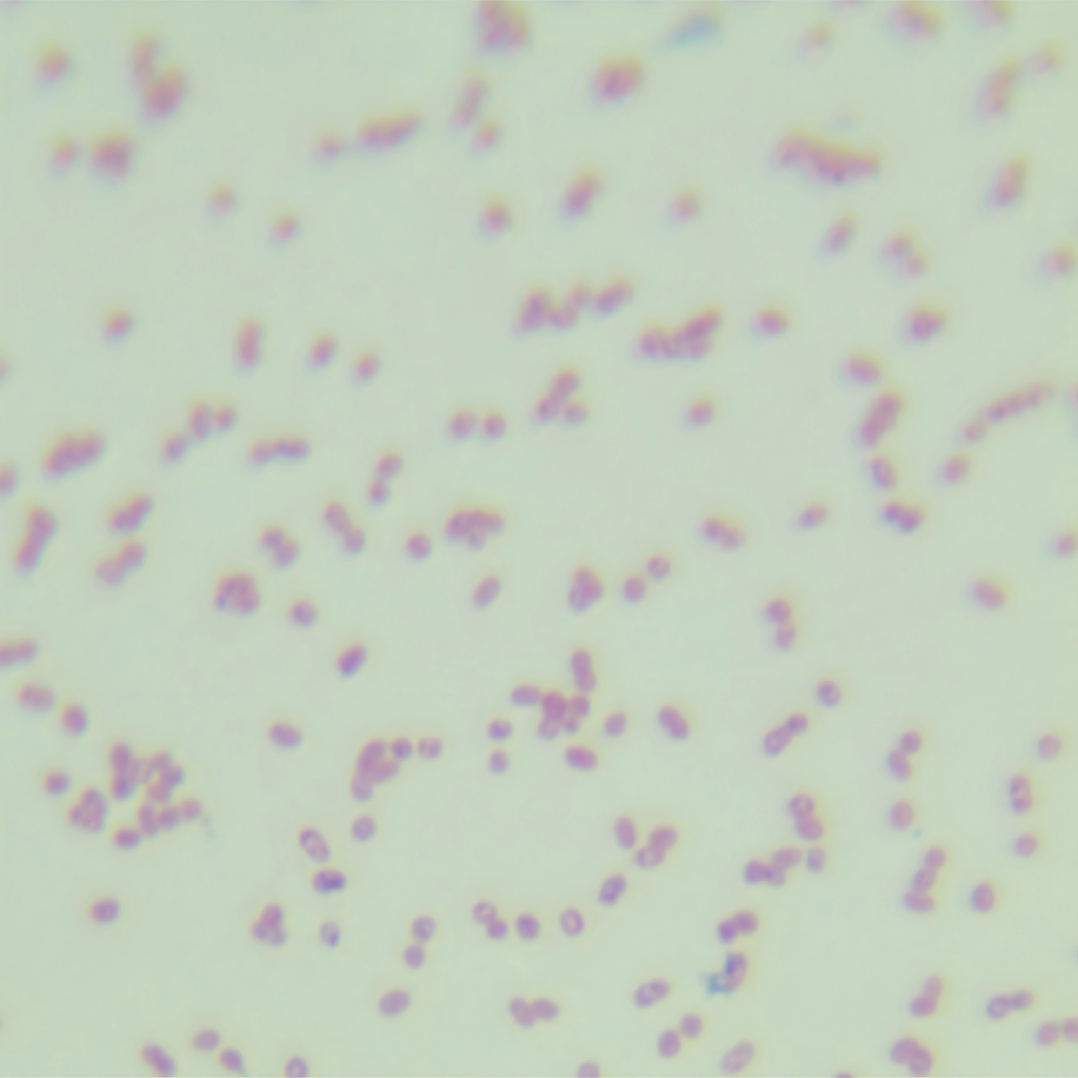 Xanthoceras salina-BNCC
