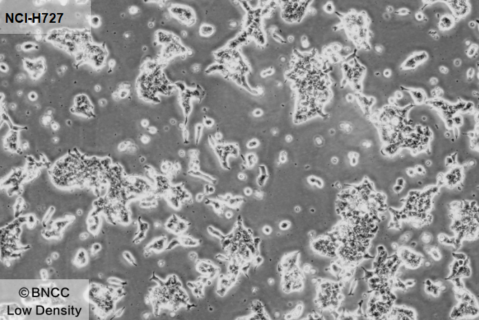 Human lung cancer cells-BNCC
