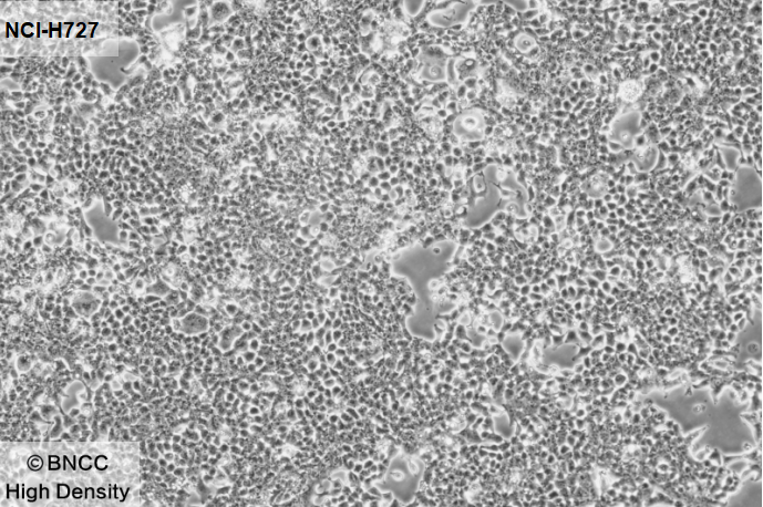 Human lung cancer cells-BNCC