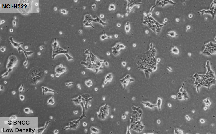 Human non-small cell lung cancer cell line-BNCC