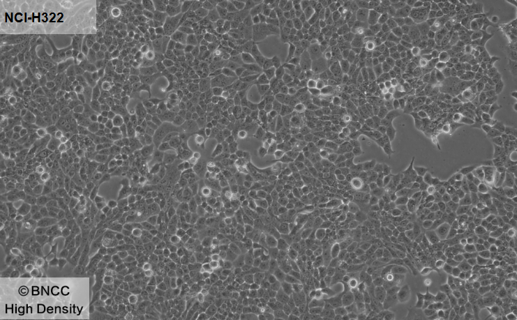 Human non-small cell lung cancer cell line-BNCC