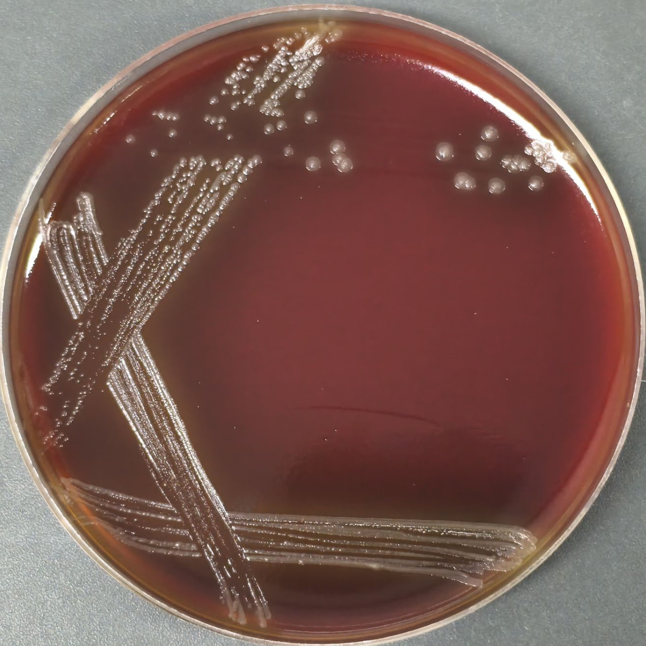 Campylobacter jejuni-BNCC