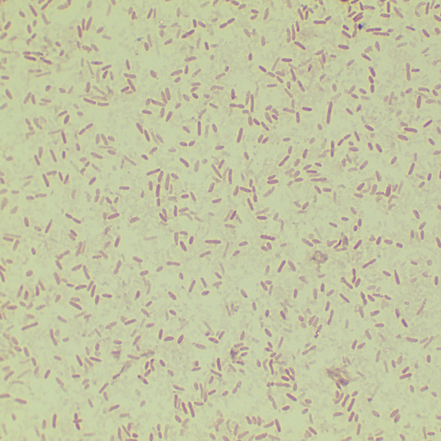 SDUM001136-BNCC