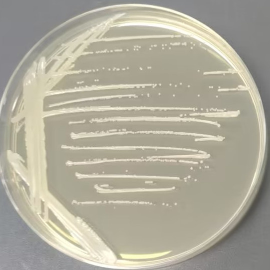 Radiation resistant Acinetobacter-BNCC