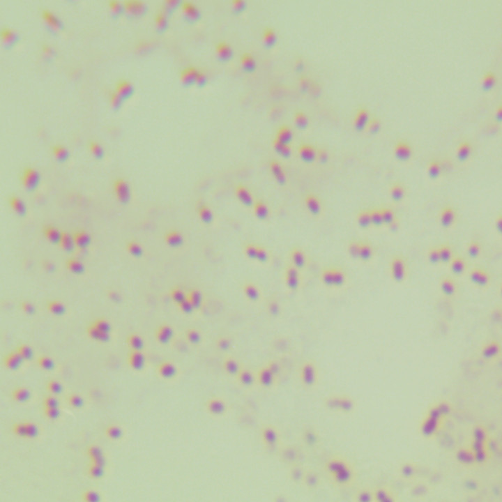 Radiation resistant Acinetobacter-BNCC