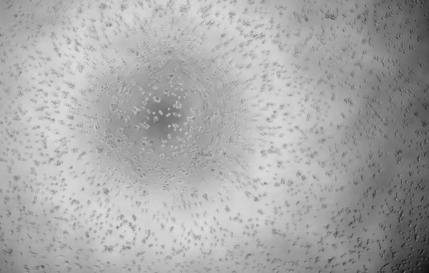 Coxsackievirus A10-BNCC