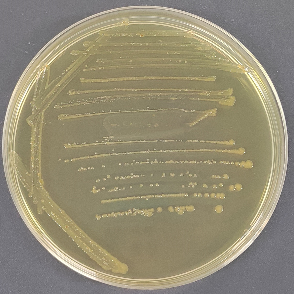 Hemophilus salivarius-BNCC