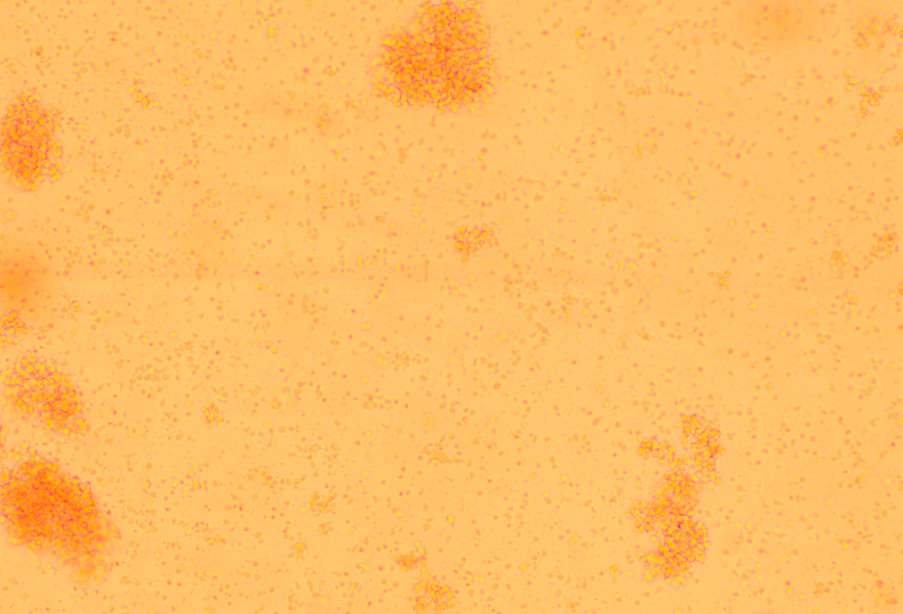 Peripheral blood mononuclear cells-BNCC