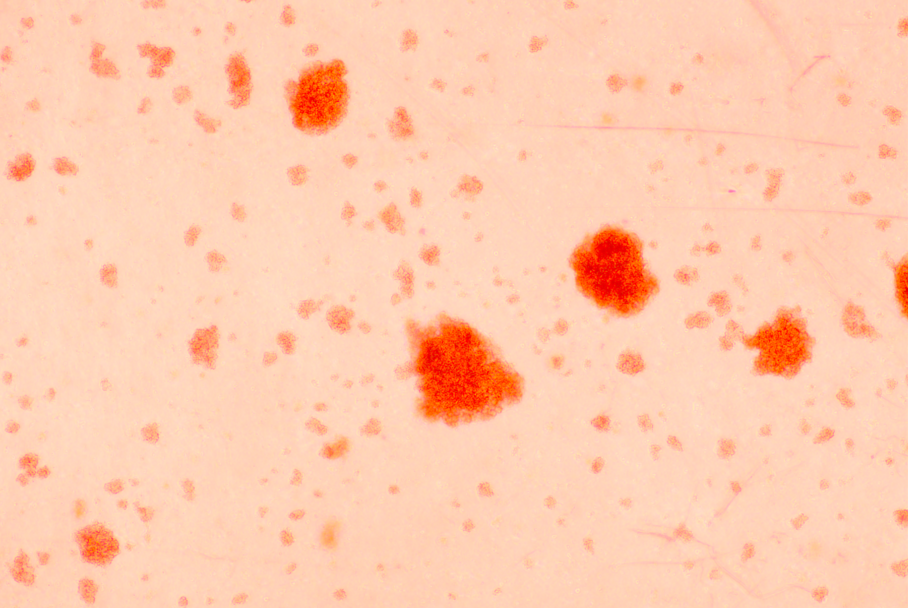 Peripheral blood mononuclear cells-BNCC