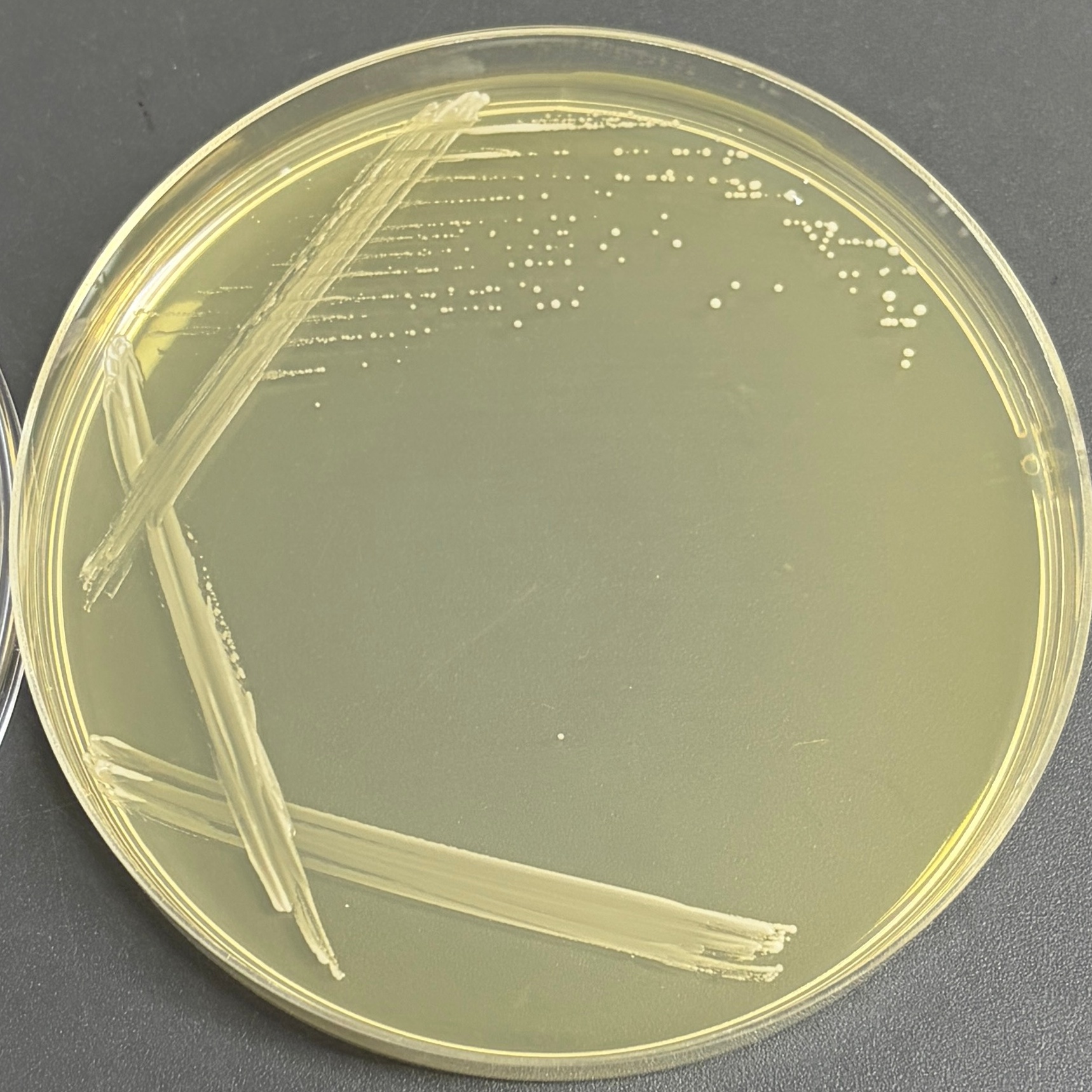 Pingtuo Peisi yeast-BNCC