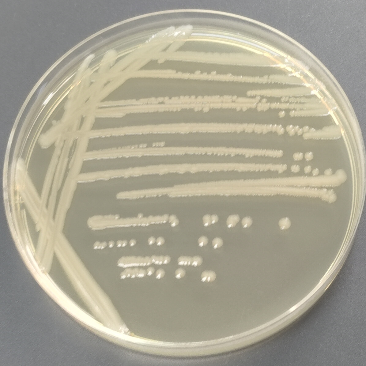 Salmonella havana-BNCC