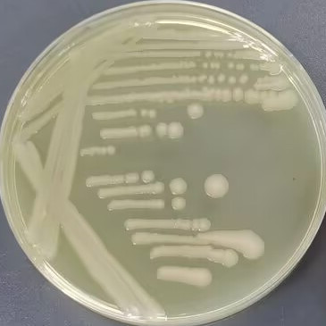 Salmonella mbandaka-BNCC
