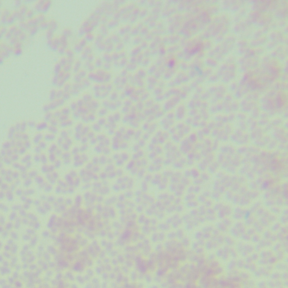 Salmonella assinie-BNCC