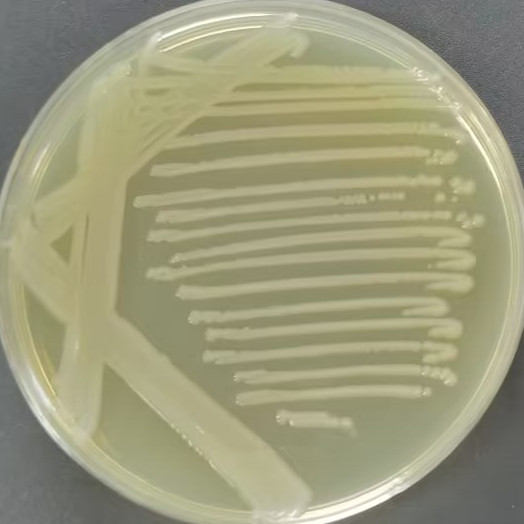 Salmonella schwarzengrund II-BNCC
